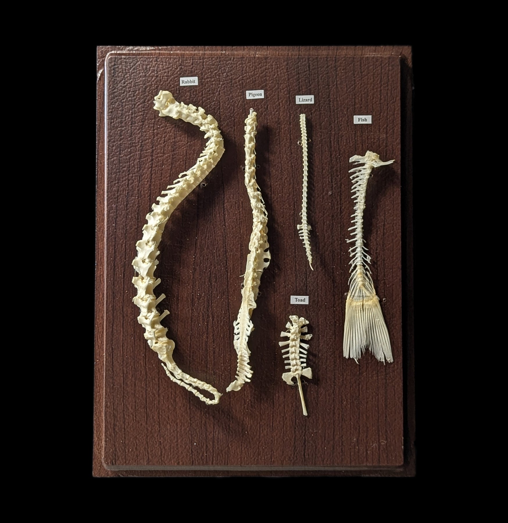 Spinal Column Comparisons - Anatomy Models for Medical Students & Professionals | Perfect for Study, Teaching & Clinical Reference