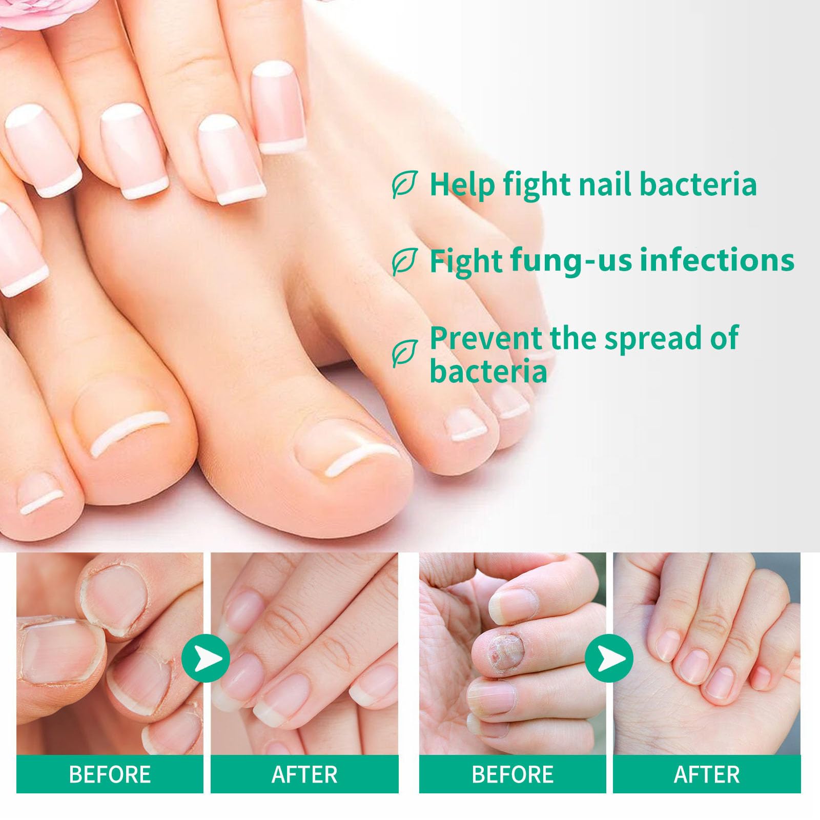 Extra Strength Toenail Fungus Treatment - Fast-Acting Nail Repair Solution for Damaged & Discolored Nails - Fungal Nail Renewal Liquid (2 Pack) - Ideal for Athletes, Swimmers & Pedicure Lovers