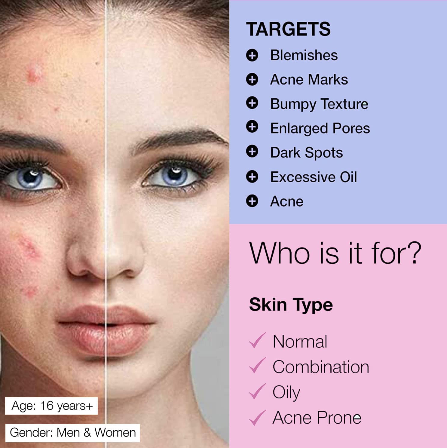 Teepzeey 2% Salicylic Acid Face Serum for Acne, Blackheads & Pore Minimizing - 40ml Oil Control Treatment for Oily, Combination & Sensitive Skin | Reduces Breakouts & Improves Skin Texture | Daily Skincare Routine & Nighttime Use