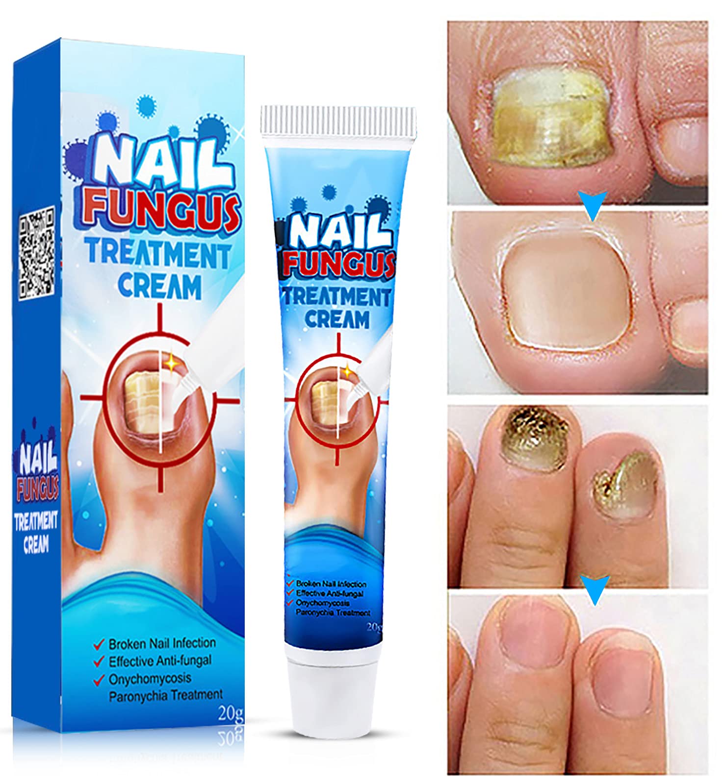 Nail Repair Cream for Toenail Fungus Treatment – Effective Fungus Remover & Foot Nail Care to Restore Healthy Nails | Ideal for Athletes, Pedicures & Daily Foot Care