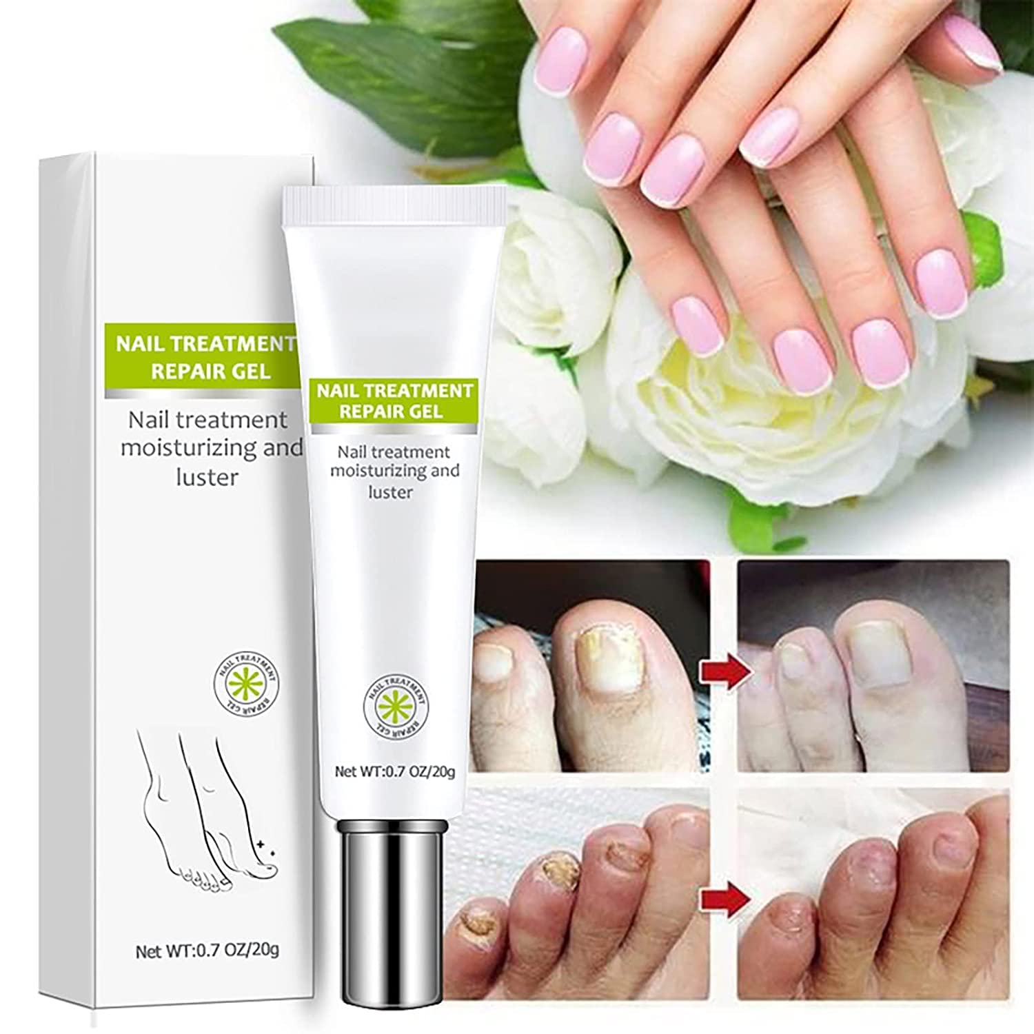 Flyles Nail Repair Treatment Gel - Restores Discolored & Damaged Nails, Strengthens & Protects Natural Nails (2 Pack) | Perfect for Manicures, Nail Care Routine & Salon Treatments