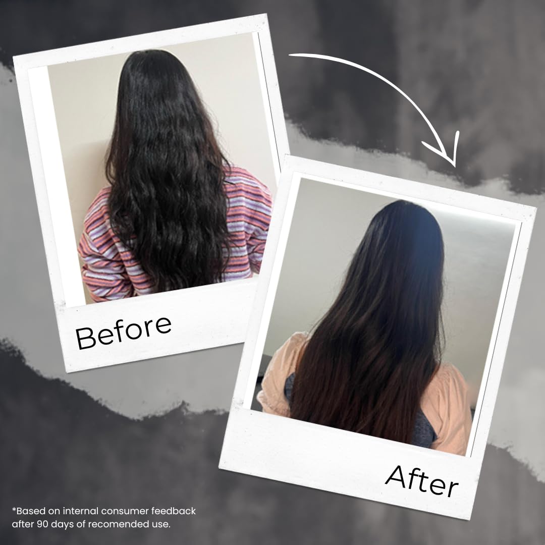 TRU HAIR & SKIN Onion & Rosemary Hair Growth Oil - 100% Pure Natural Treatment for Hair Loss & Thinning Hair - 110ml with Free Hair Heater | Perfect for Daily Scalp Massage & Overnight Hair Care