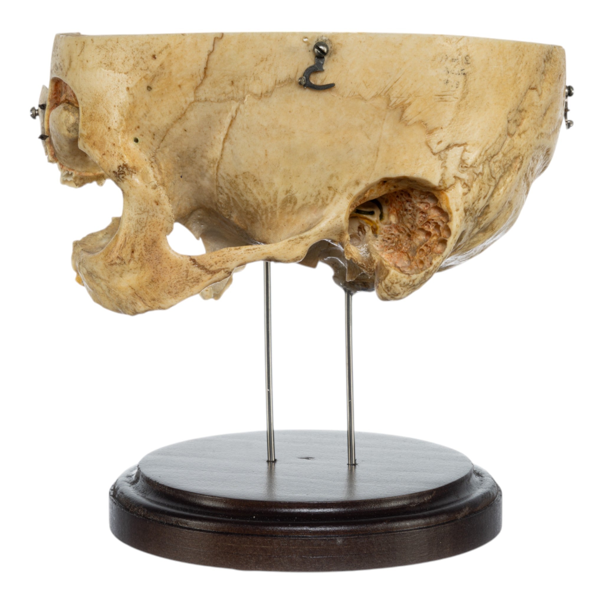 Real Human Partial Skull Replica with Display Stand - Perfect for Anatomy Study, Medical Education & Halloween Decor