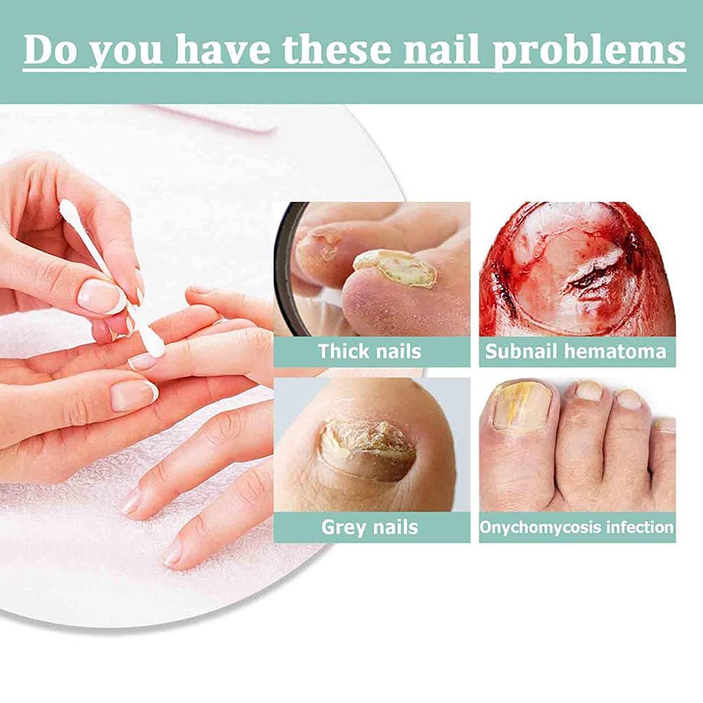 Nail Growth Serum & Repair Pen - Cuticle Oil Treatment for Toenail & Fingernail Fungus - Damaged Nail Care Set (5pcs) - Perfect for At-Home Manicures & Pedicures