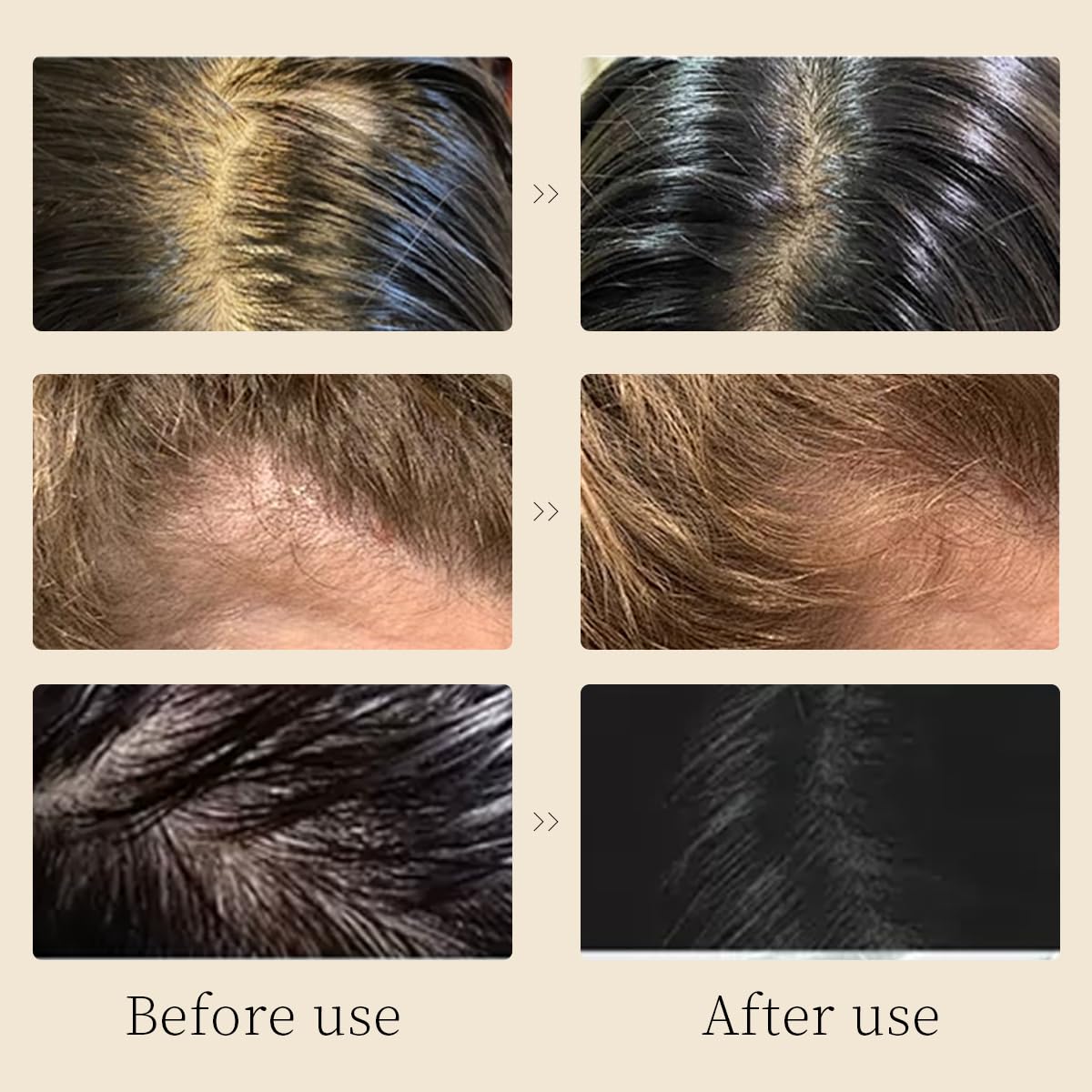 Anti Hair Loss Shampoo for Women & Men - Nourishing & Repairing Treatment for Thinning Hair - Stimulates Hair Growth with Natural Ingredients - Perfect for Daily Use & Post-Chemo Hair Care