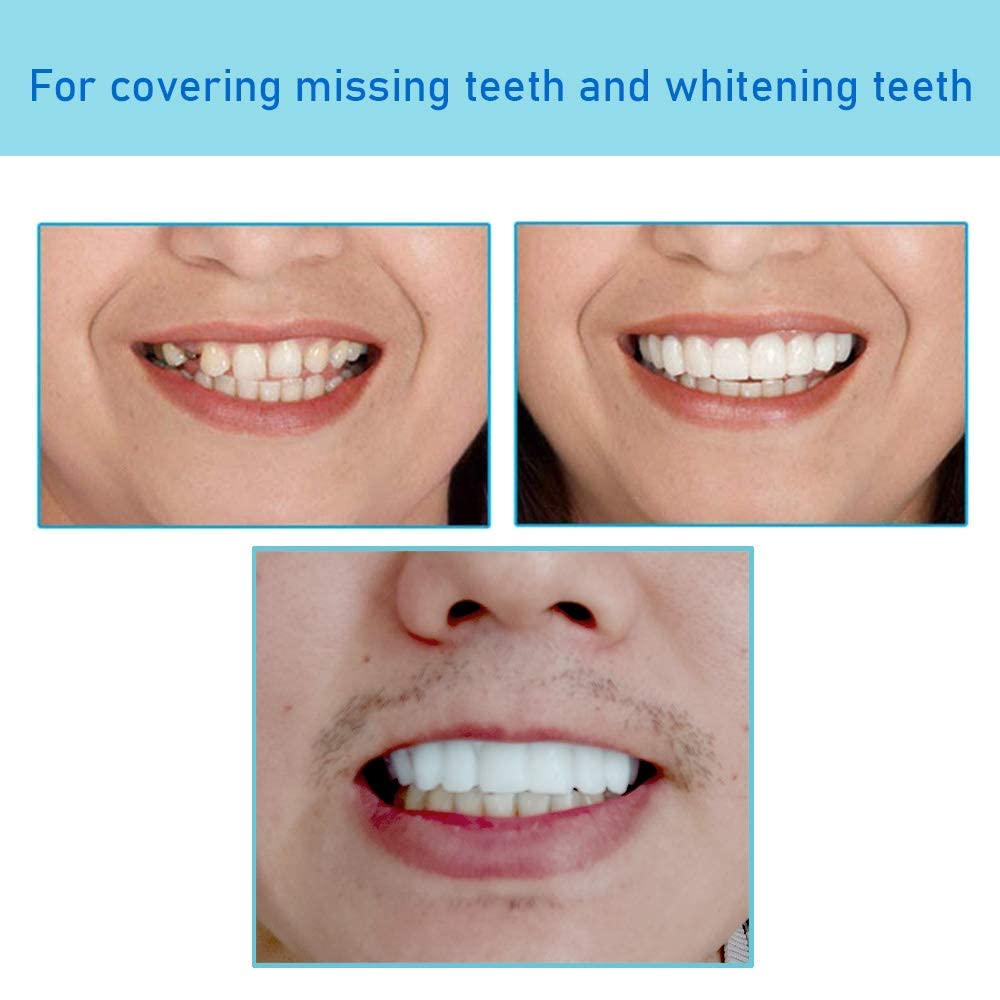 Temporary Denture Teeth - Snap-On Fake Teeth for Instant Smile & Confidence Boost - Perfect for Cosplay, Halloween, and Dental Emergencies