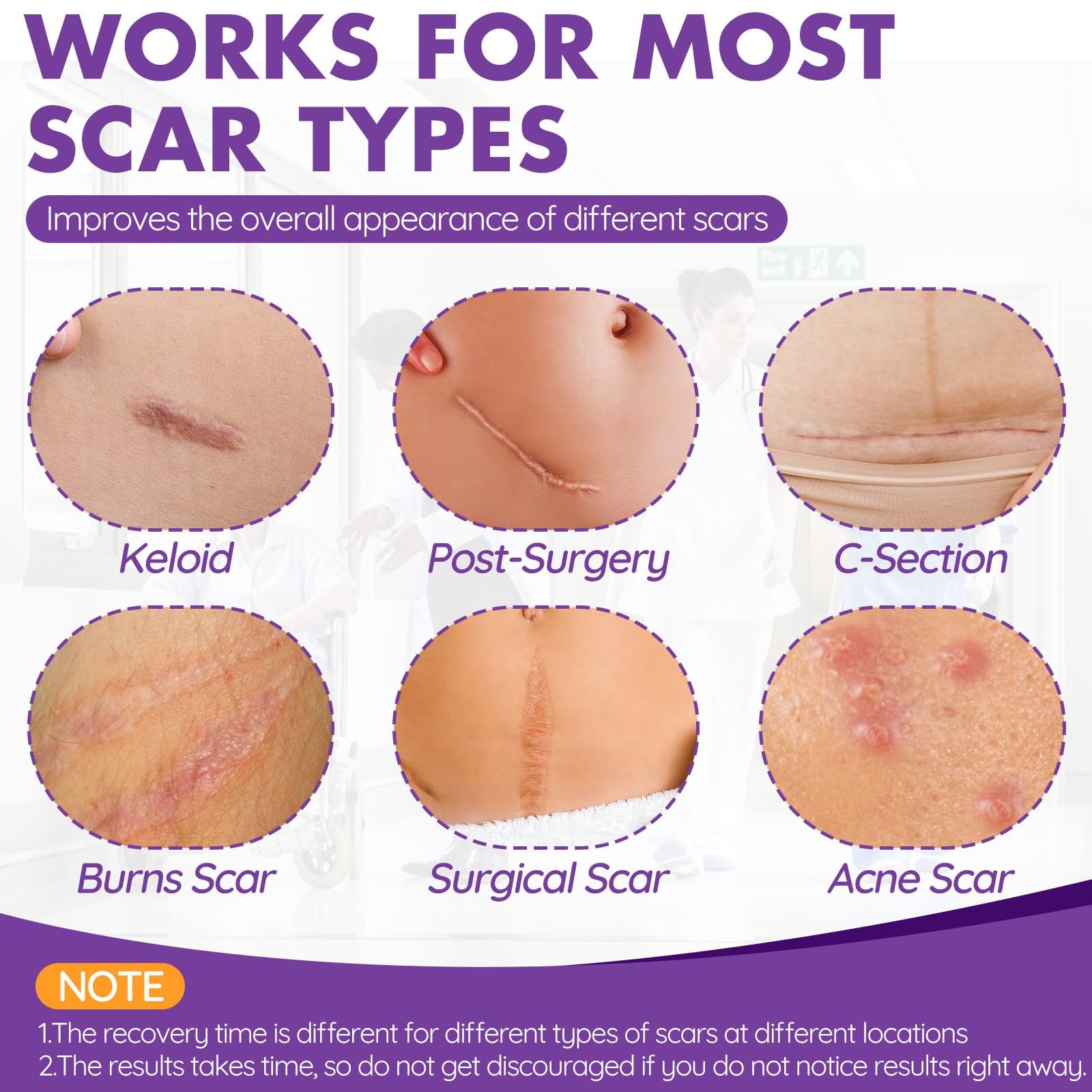 Professional Reusable Silicone Scar Sheets & Tape (1.6