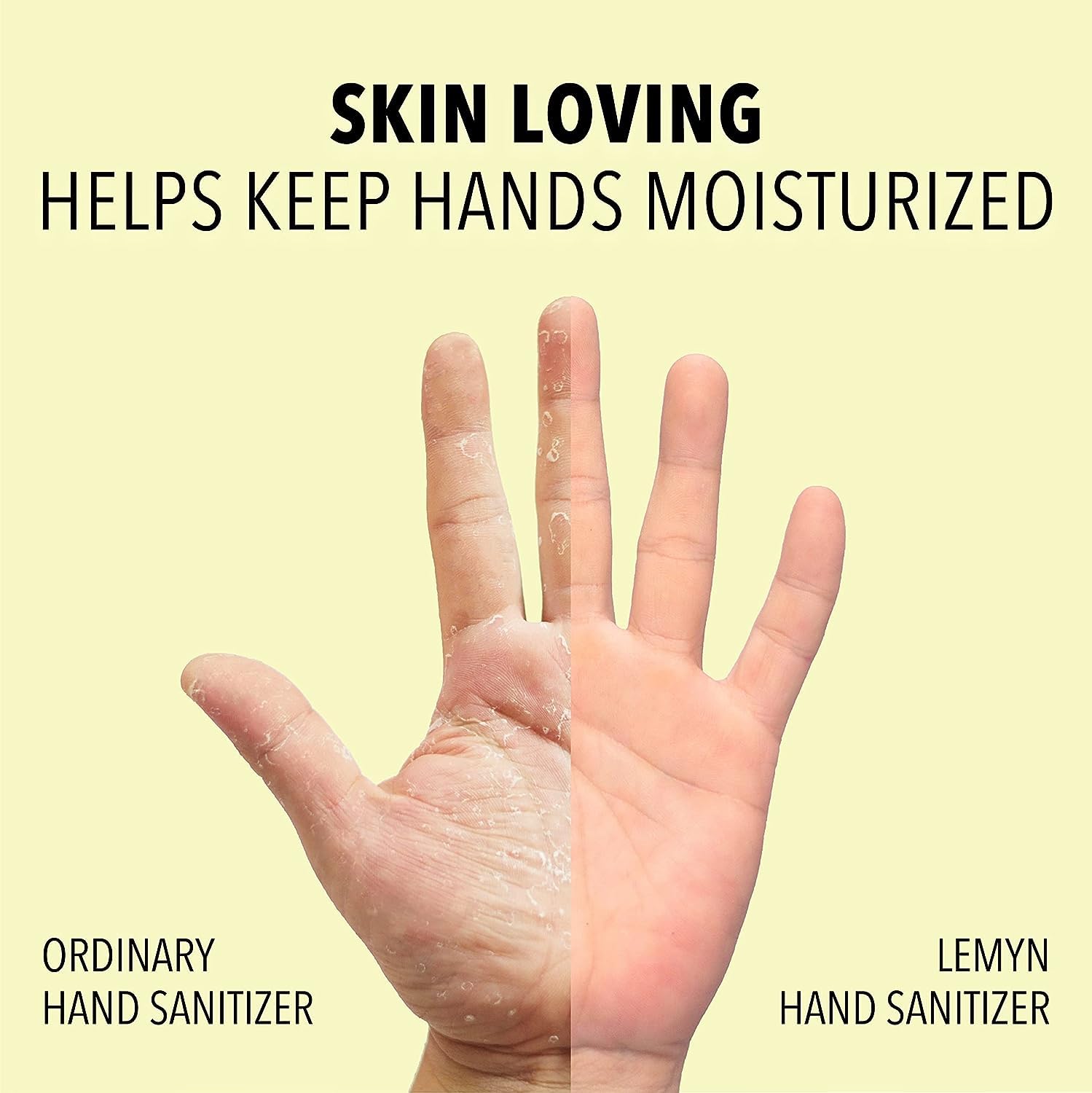 Medical Grade Hand Sanitizer Gel - 97% Organic Alcohol - 8 Fl Oz Flip-Top Bottle (Pack of 12) | Kills 99.9% Germs | Travel Size, Office, School & Home Use
