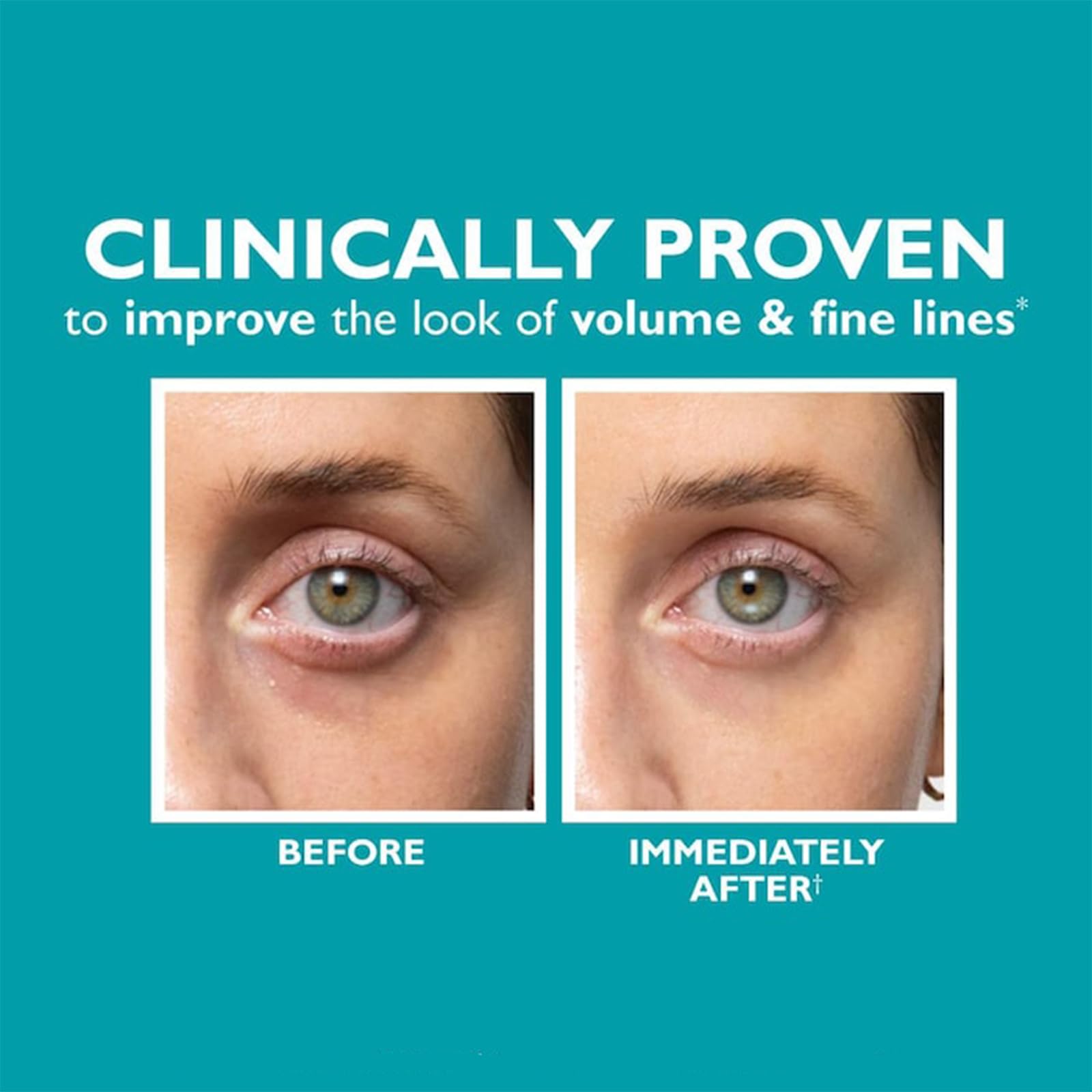 **Peptide Under-Eye Cream for Dark Circles & Wrinkles – Anti-Aging Eye Serum to Reduce Puffiness, Fine Lines & Firm Skin – Fill + Fix Skinjection Treatment (1PC) – Perfect for Nighttime Skincare & Travel**