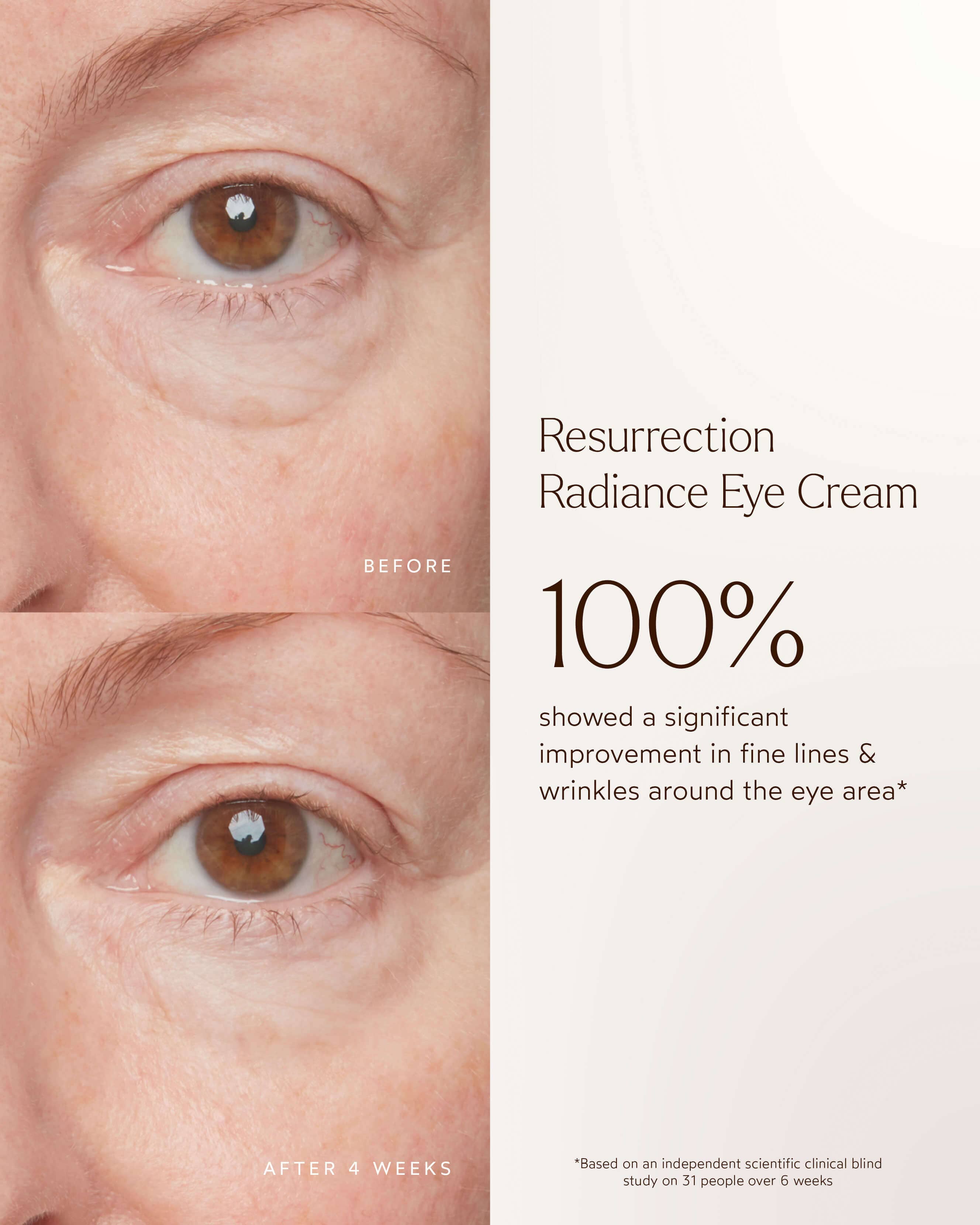 Resurrection Radiance Anti-Aging Eye Cream for Dark Circles & Wrinkles - Hydrating Under Eye Treatment for Puffiness & Fine Lines - Perfect for Nighttime Skincare Routine & Daily Use