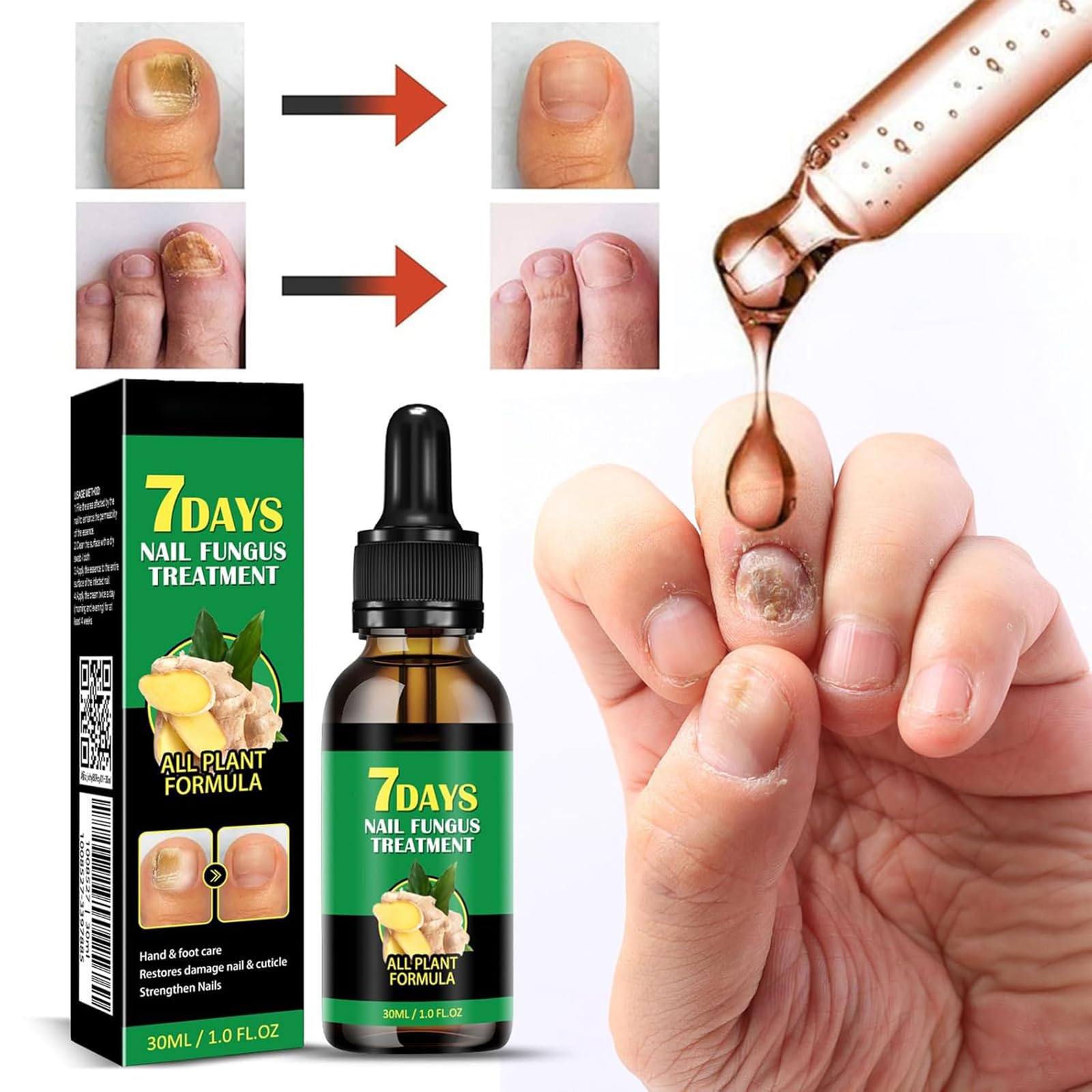 7 Days Ginger Nail Growth Treatment & Cuticle Care Oil - Strengthening Nail Serum for Healthy Nails (2PCS) - Perfect for Brittle Nails & At-Home Manicures