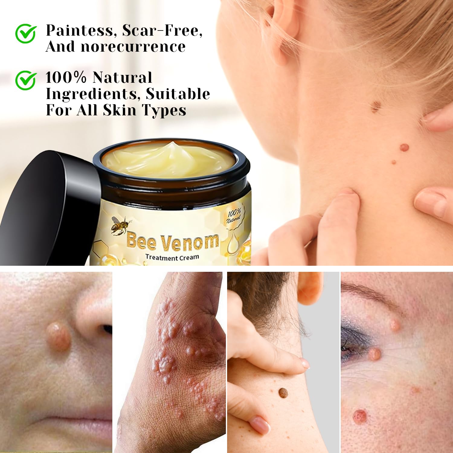 2025 New Bee Venom Treatment Cream - Professional Natural Repair Gel for All Skin Types (2 Bottles) | Soothes Dryness, Redness & Skin Irritation | Perfect for Daily Skincare & Post-Treatment Care