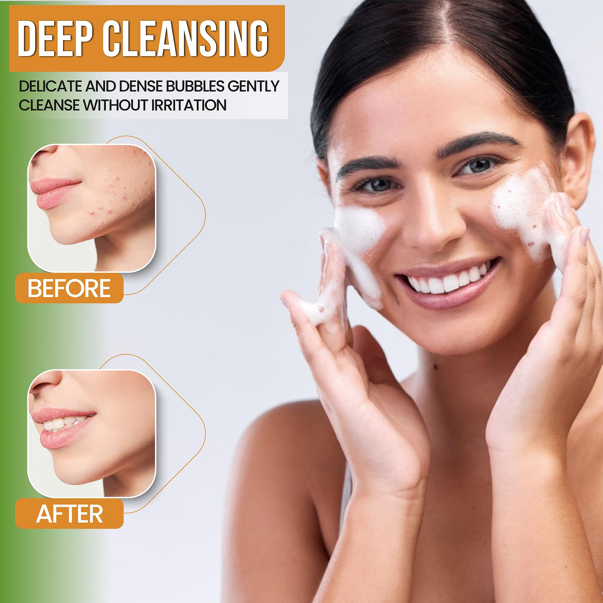 Turmeric Face Wash for Acne & Brightening - Natural Gentle Daily Cleanser with Organic Ingredients - Perfect for Sensitive Skin & Morning Skincare Routine