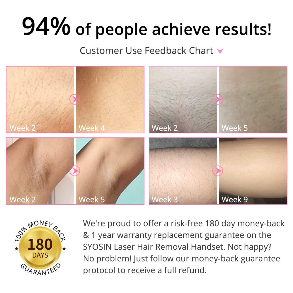 Professional IPL Hair Removal Device for Women & Men - Permanent Hair Reduction at Home - Painless & Effective for Legs, Face, Bikini Line, Underarms - Salon-Quality Results