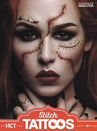 Stitches