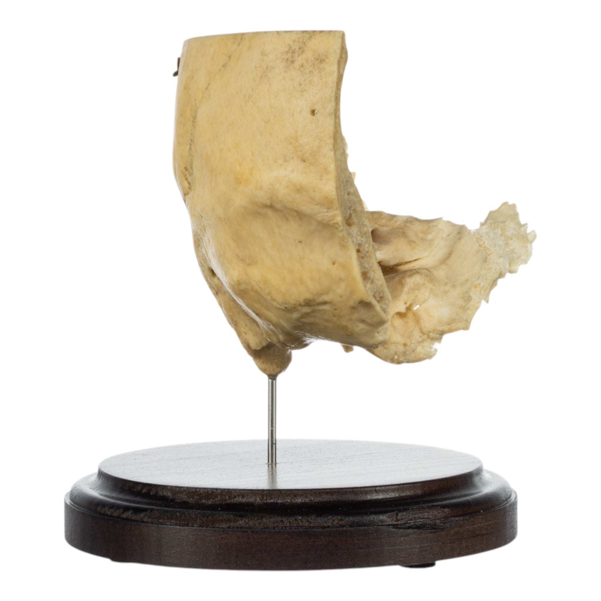 Authentic Real Human Partial Skull with Display Stand - Perfect for Medical Education, Anatomy Study & Halloween Decor