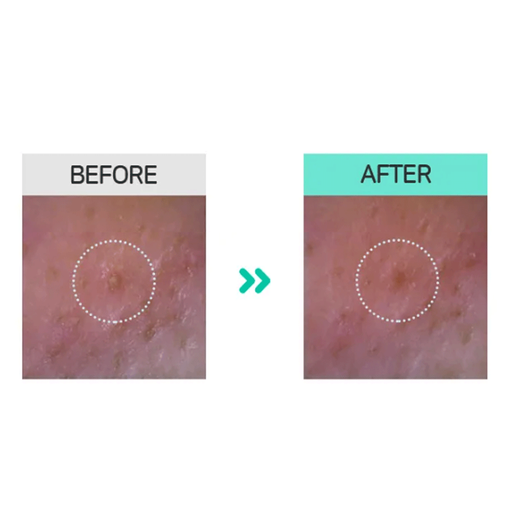 BRING GREEN Bamboo Charcoal Pore & Blackhead Remover Mask - Deep Cleansing Facial Treatment for Acne & Oily Skin - 110g - Perfect for Daily Skincare & Spa Nights