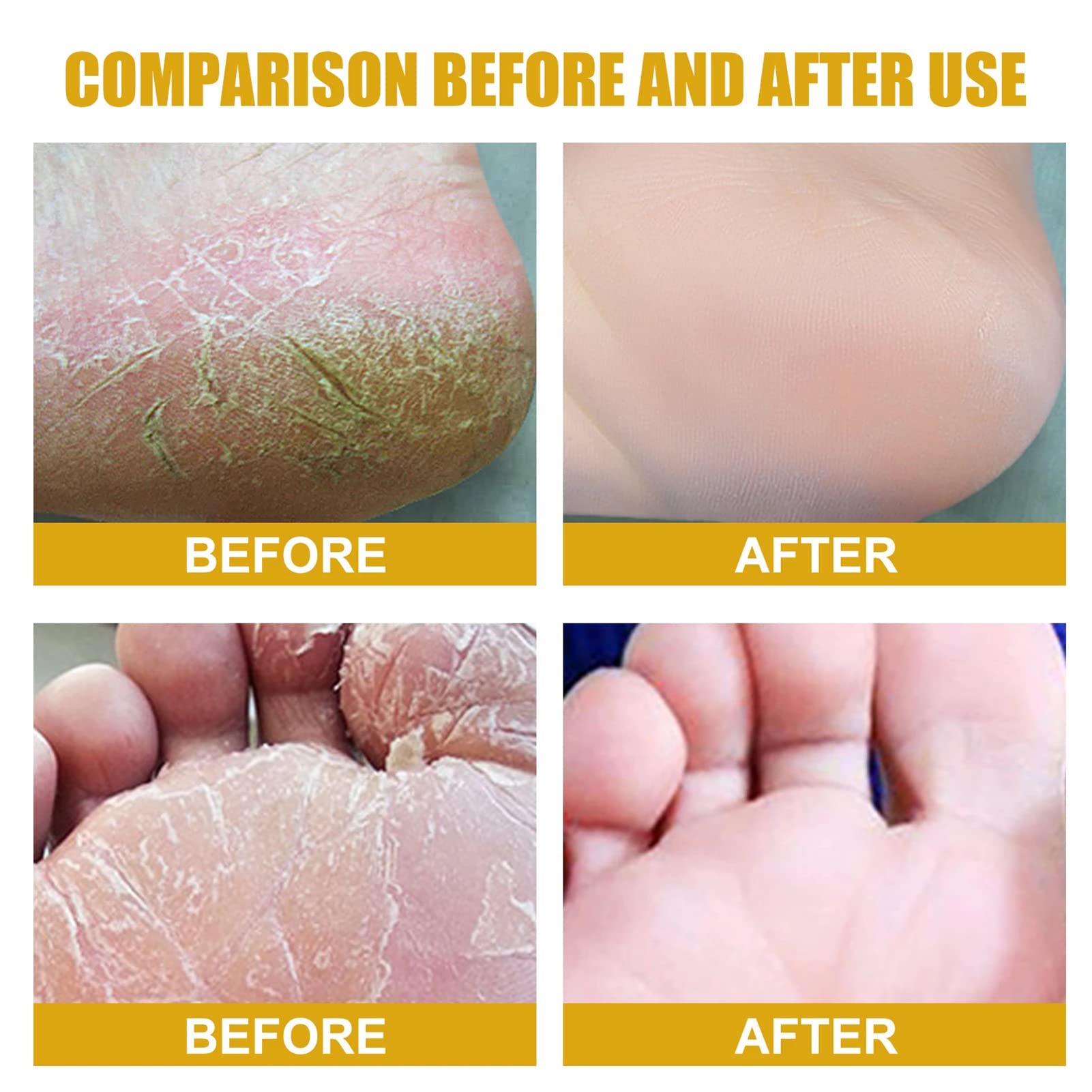 Banana Foot Repair Cream for Dry Cracked Feet - Natural Moisturizing Foot Cream for Cracked Heels & Rough Skin - Best Foot Care for Cracked Skin Treatment - Perfect for Dry Winter Feet & Post-Pedicure Care (1PCS)
