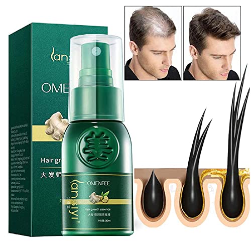 3PCS Ginger Hair Growth Essential Spray - 30ml Hair Growth Serum for Thinning & Balding Hair - Anti Hair Loss Treatment with Hair Follicle Repair - Promotes Hair Regrowth for Men & Women - Perfect for Daily Scalp Care & Hair Thickening Routine