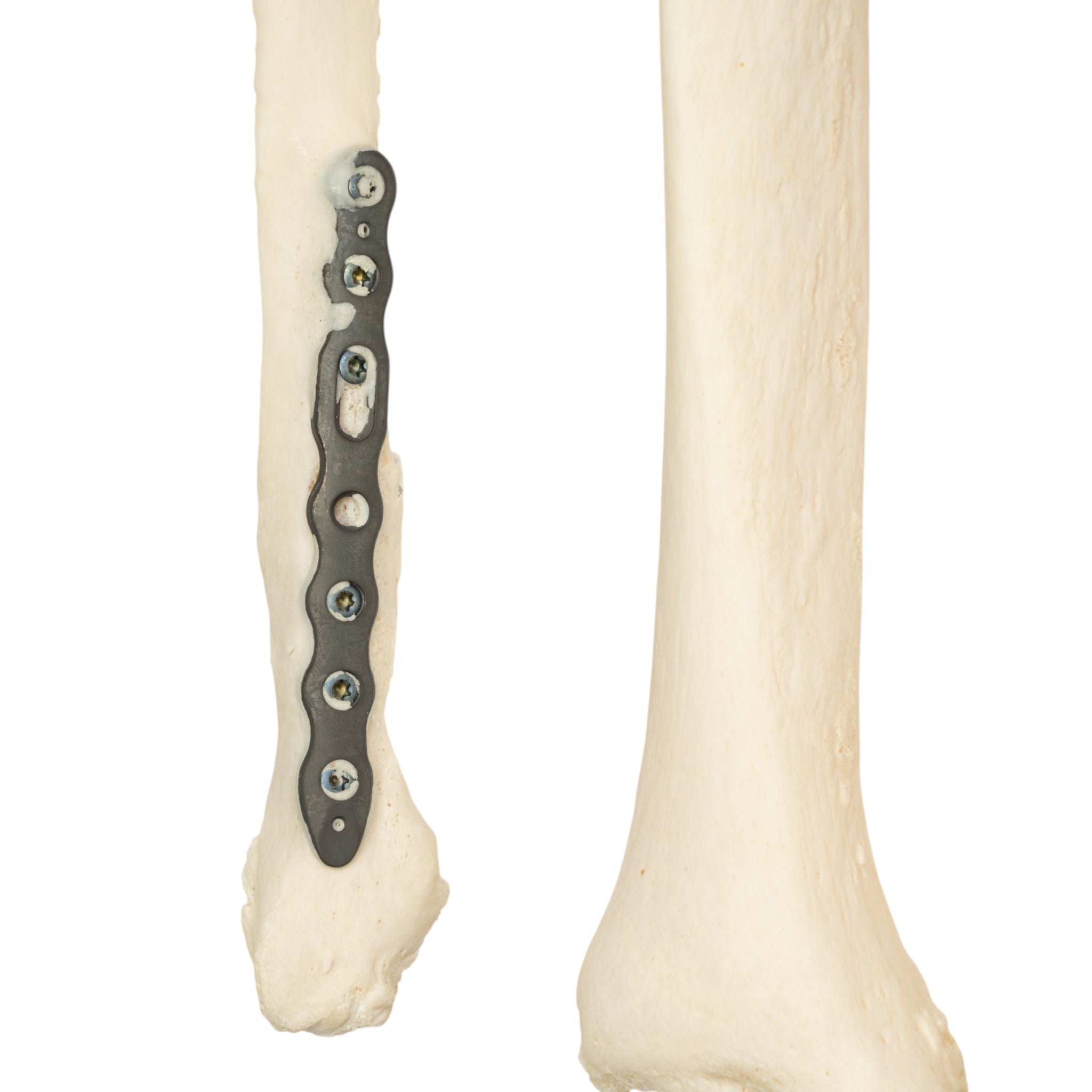 Premium Disarticulated Human Skeleton Model - Anatomically Accurate for Medical Education & Research - Perfect for Classroom, Lab Study, and Medical Training