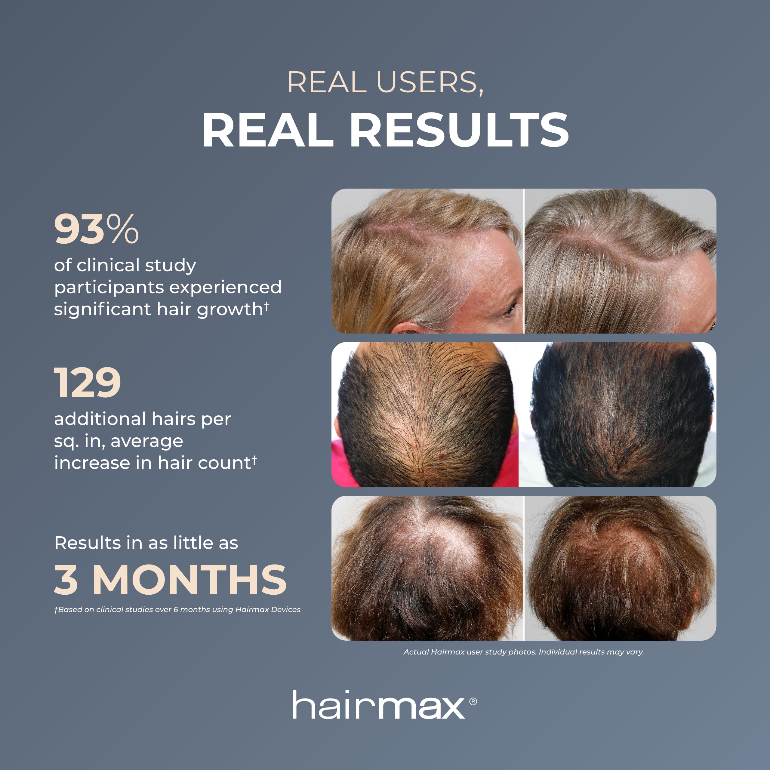 HairMax Ultima 9 Classic LaserComb - FDA Cleared Laser Hair Growth Device for Men & Women - Red Light Therapy Treatment for Thinning Hair & Hair Loss Prevention - Cordless Hair Regrowth Comb for Home Use - Perfect for Daily Hair Care Routine & Scalp Health Maintenance