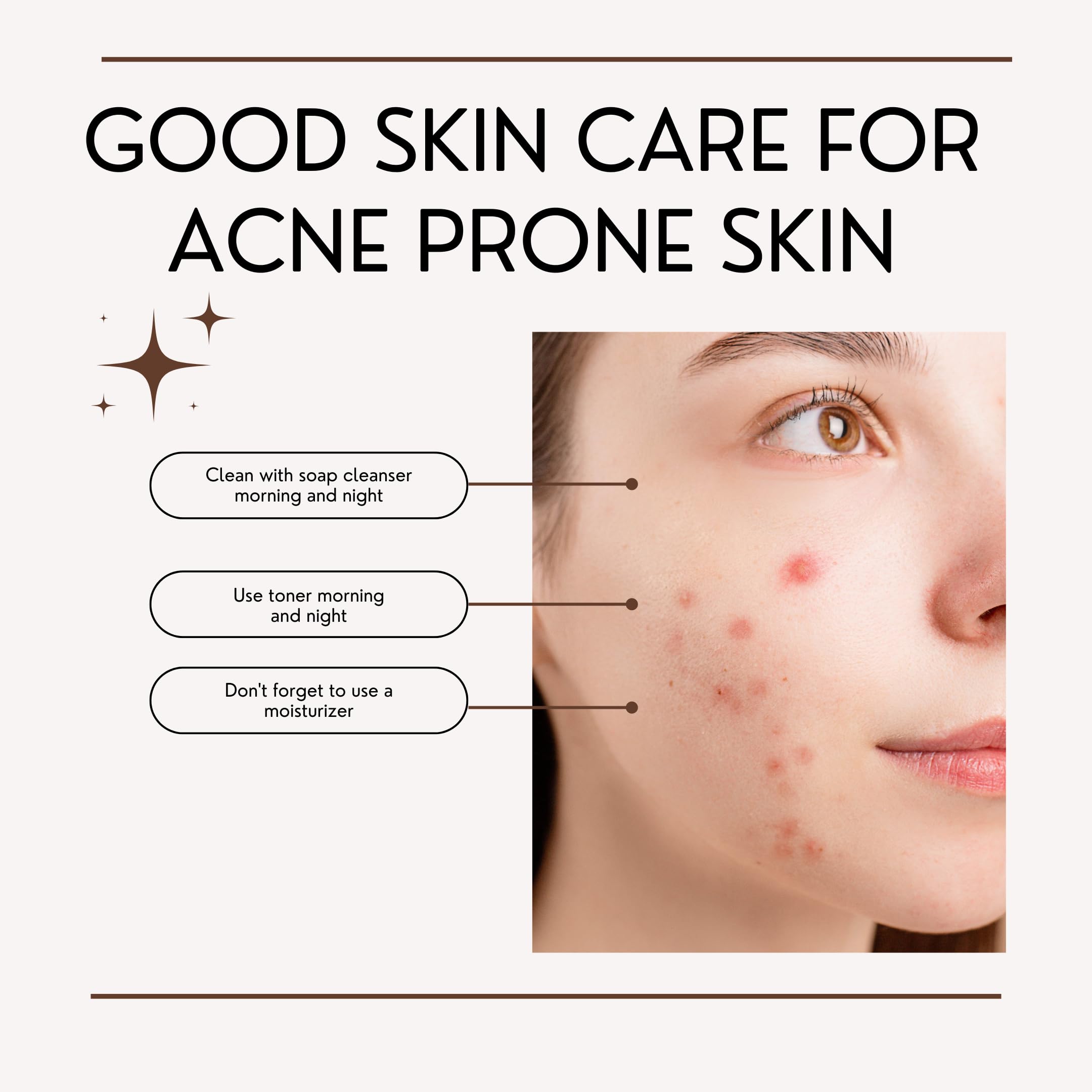 Acne Fighting Benzoyl Peroxide Face Wash with Hyaluronic Acid & Exfoliating Beads - Purifying Foaming Cleanser for Oily & Acne-Prone Skin (120g) | Daily Deep Cleansing & Makeup Removal for Clear, Renewed Skin
