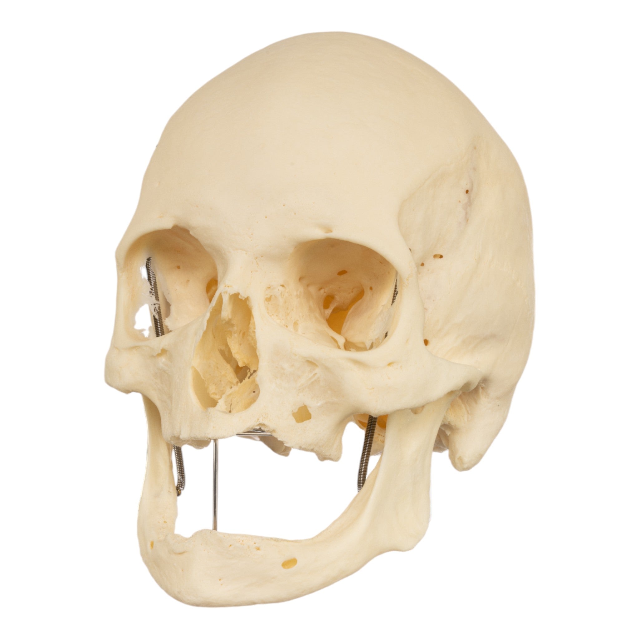 Premium Disarticulated Human Skeleton Model for Medical Study - Anatomical Pathology Teaching Aid for Students & Professionals - Perfect for Classroom, Lab & Medical Training