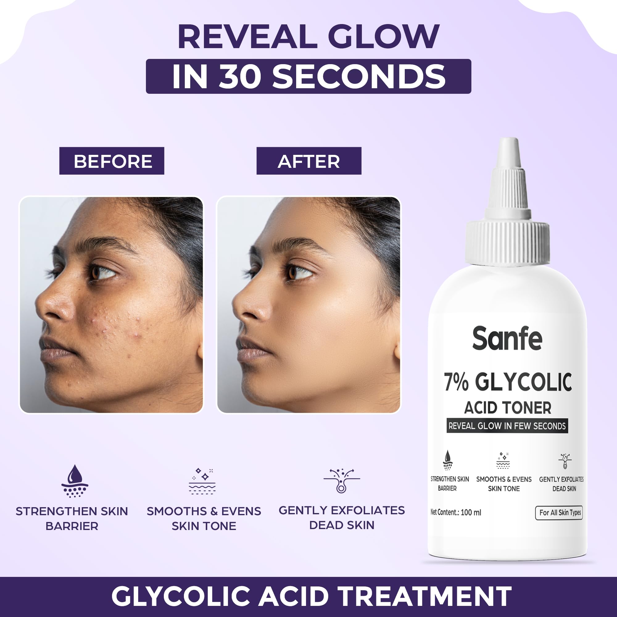 Sanfe 7% Glycolic Acid Exfoliating Toner for Face & Body - Brightens Skin, Reduces Dark Spots & Improves Texture | Gentle Chemical Exfoliator for Glowing Skin | Perfect for Daily Use on Face, Underarms & Scalp | 100ml