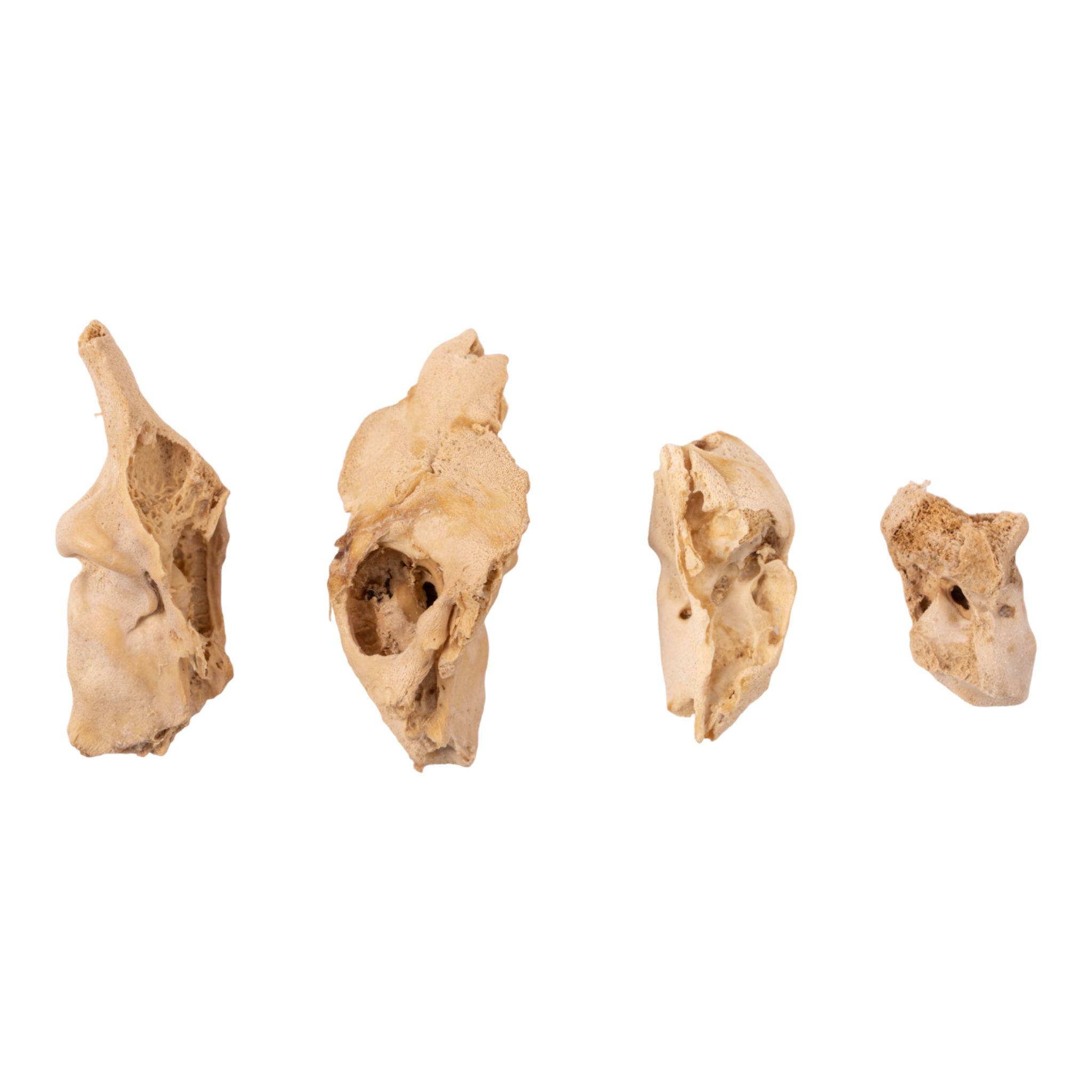 Premium Human Fetal Petrous Bone Specimen for Medical Research - Ideal for Anatomical Studies, Forensic Analysis, and Biological Research