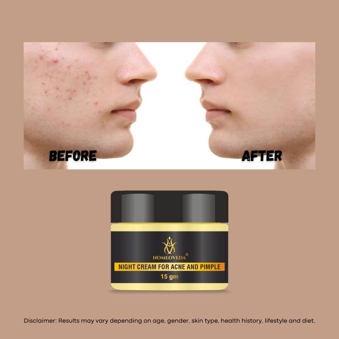 Homeoveda Handmade Acne & Pimple Removal Cream - Treats Acne Scars, Dark Spots & Blemishes with Saffron & Aloe Vera - 15g | Clear Skin Solution for Daily Face Care & Acne Treatment