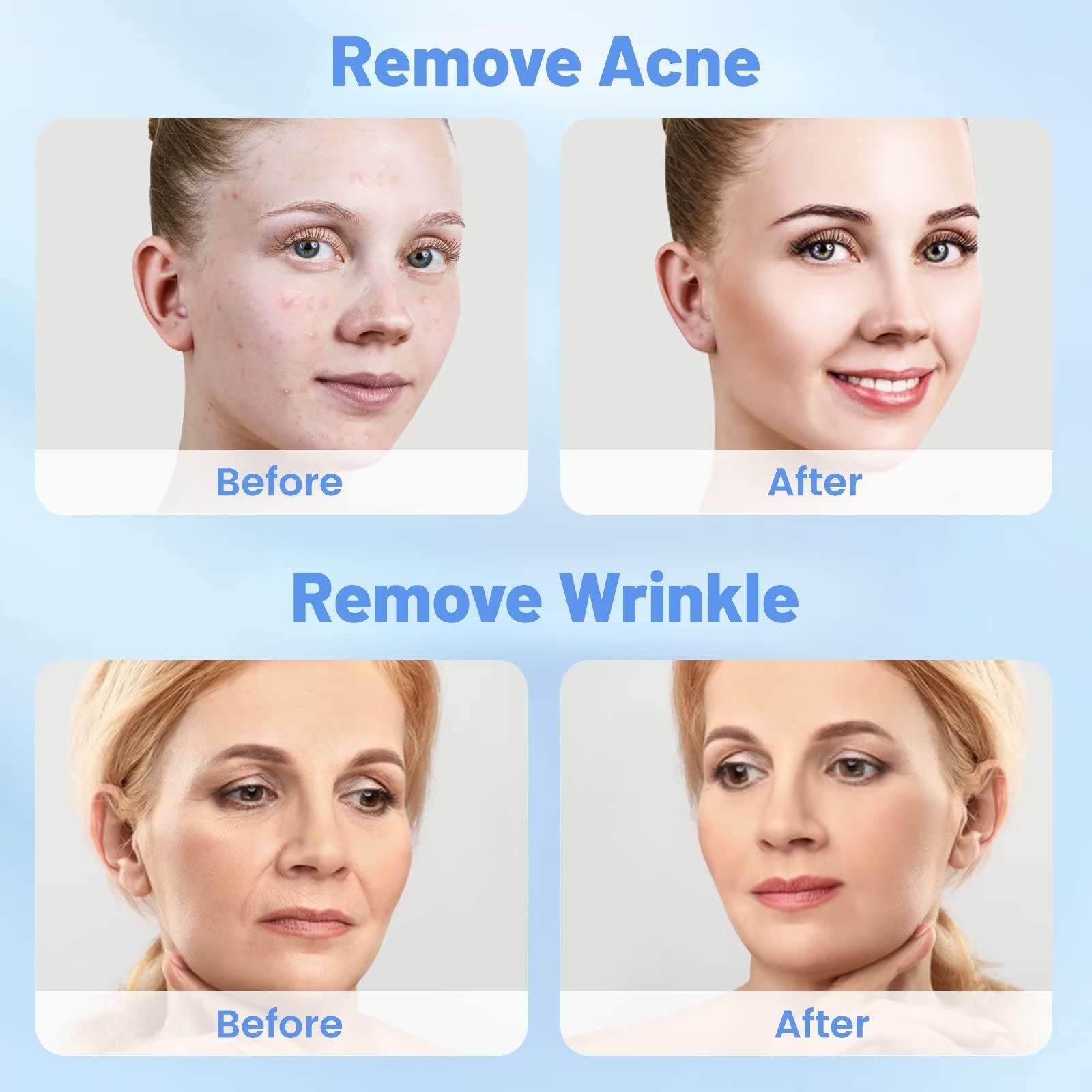 5 in 1 Micro Diamond Dermabrasion Machine - Professional Facial Machine with 68cmhg Vacuum for Home Skin Care | Blackhead Removal, Wrinkle Reduction & Skin Rejuvenation | Perfect for Spa Days & At-Home Beauty Treatments