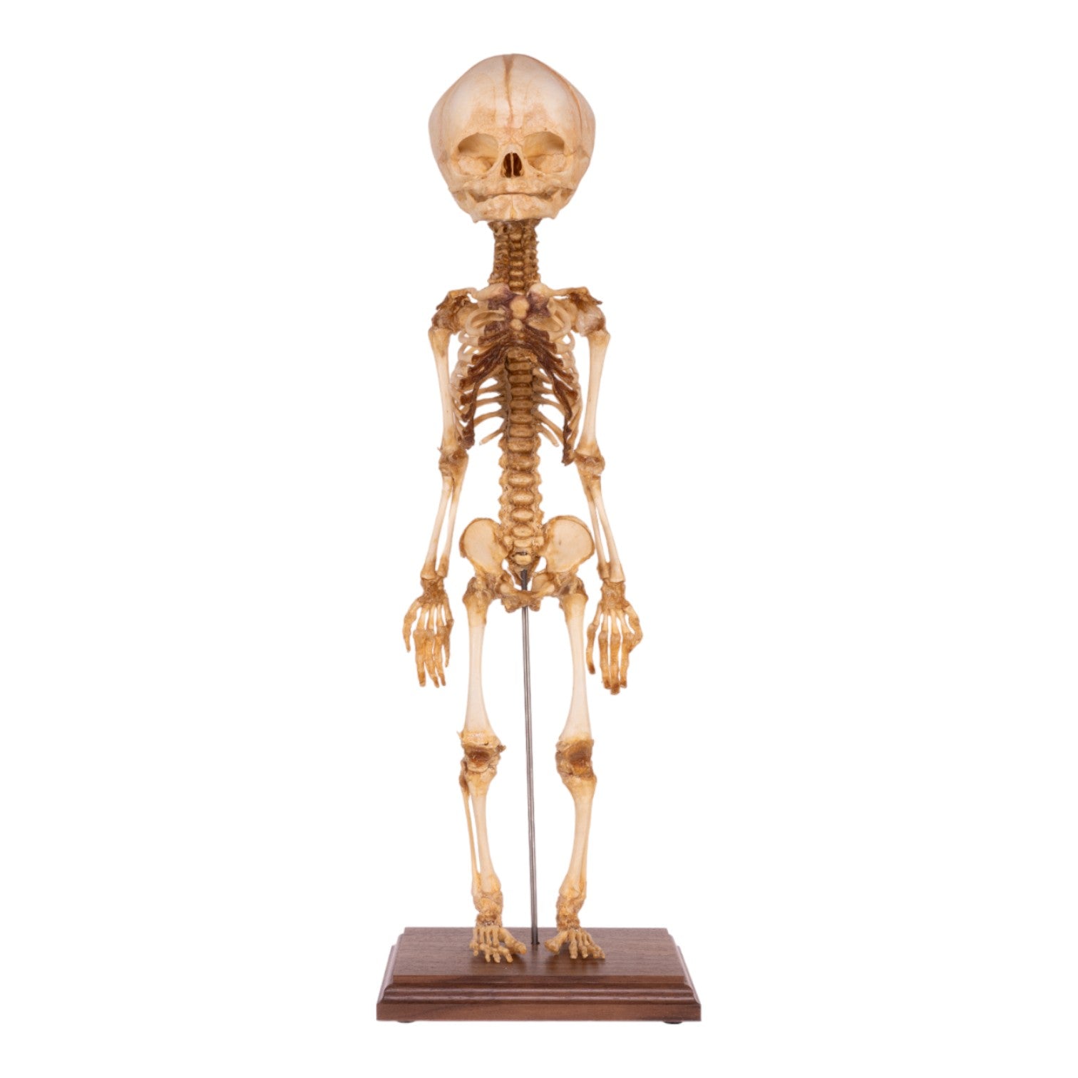 Premium Human Fetal Articulated Skeleton Model with Stand - Medical Education, Anatomy Study & Research Tool for Students and Professionals