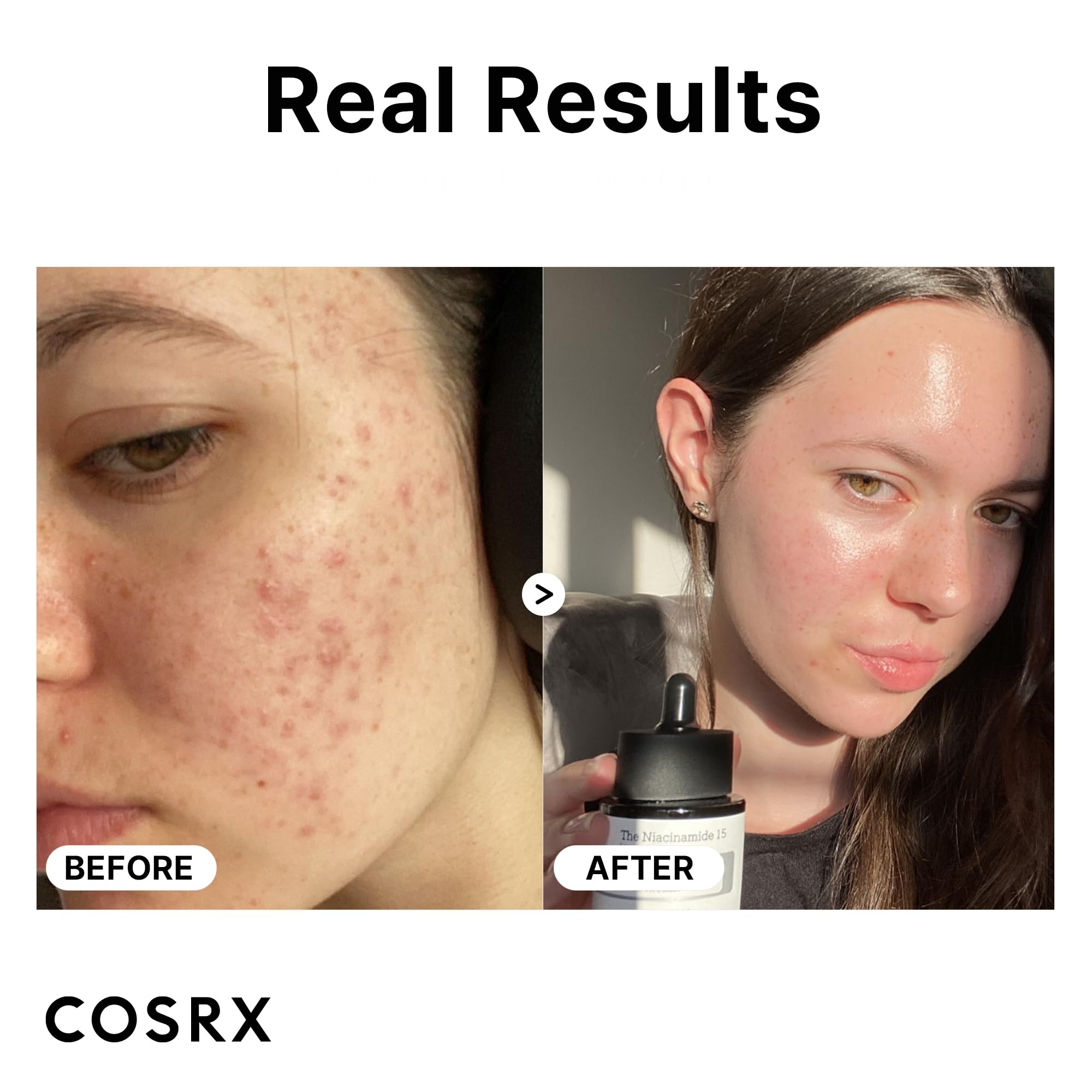 COSRX Morning Skin Care Routine - Galactomyces Balancing Essence & Niacinamide 15% Serum for Rough Skin & Pore Minimizing | Korean Skincare for Daily Use | Brightening & Hydrating Facial Treatment for Glowing Skin | Perfect for AM Routine & Sensitive Skin Care