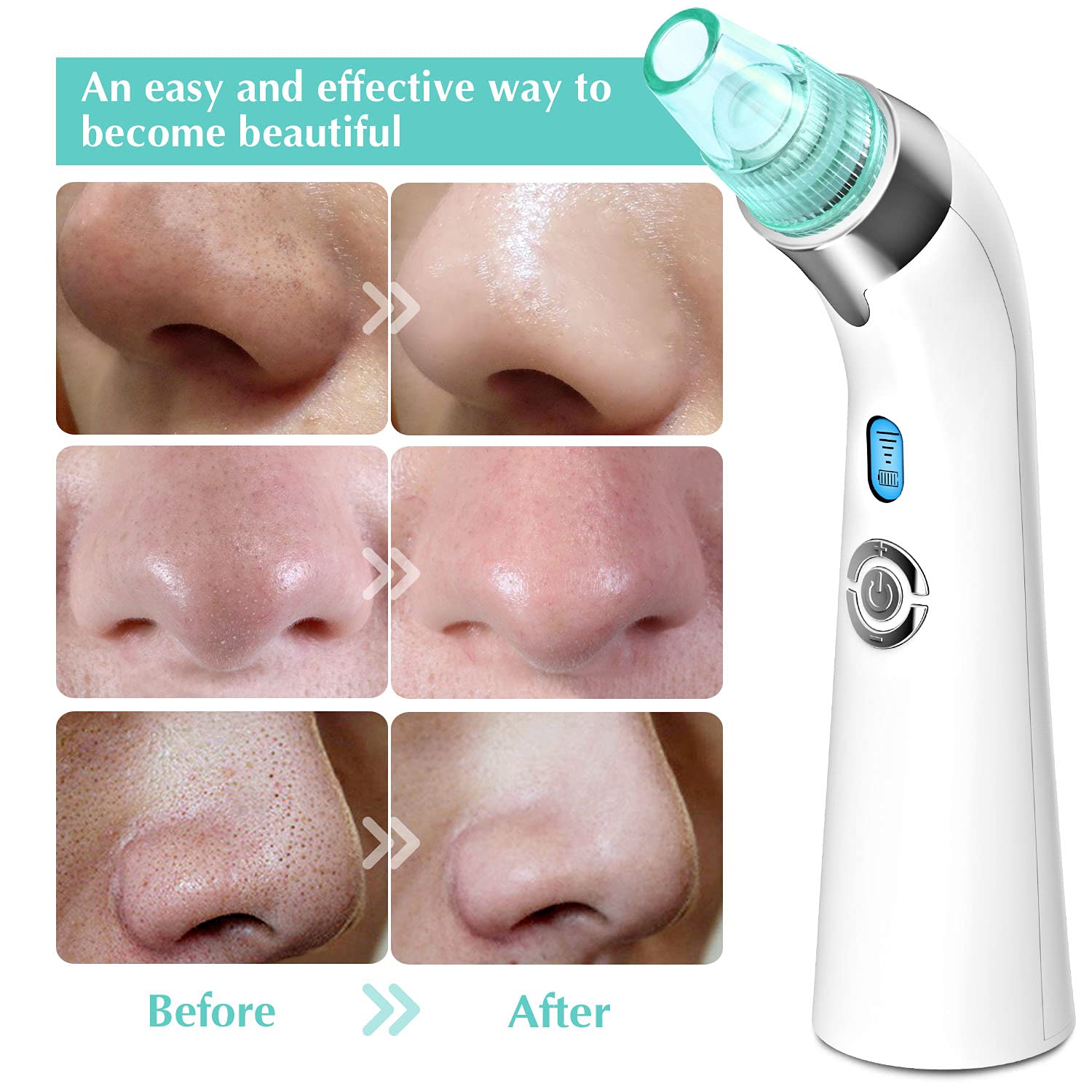 USB Rechargeable Blackhead Remover Vacuum - 5-Level Adjustable Pore Cleaner with 4 Replacement Probes for Acne & Comedone Extraction | Perfect for Home Skincare Routine & Facial Treatment