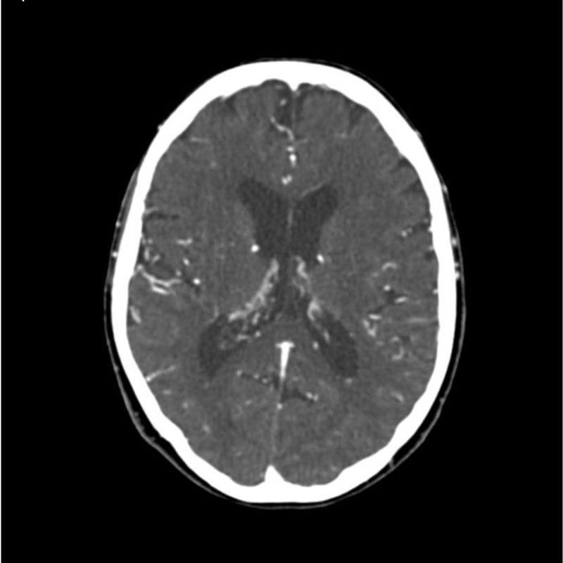 Professional CTA Head and Neck Phantom - High-Quality CT Scan & X-Ray Training Model for Medical Education | Perfect for Radiology Students, Technicians & Clinical Practice