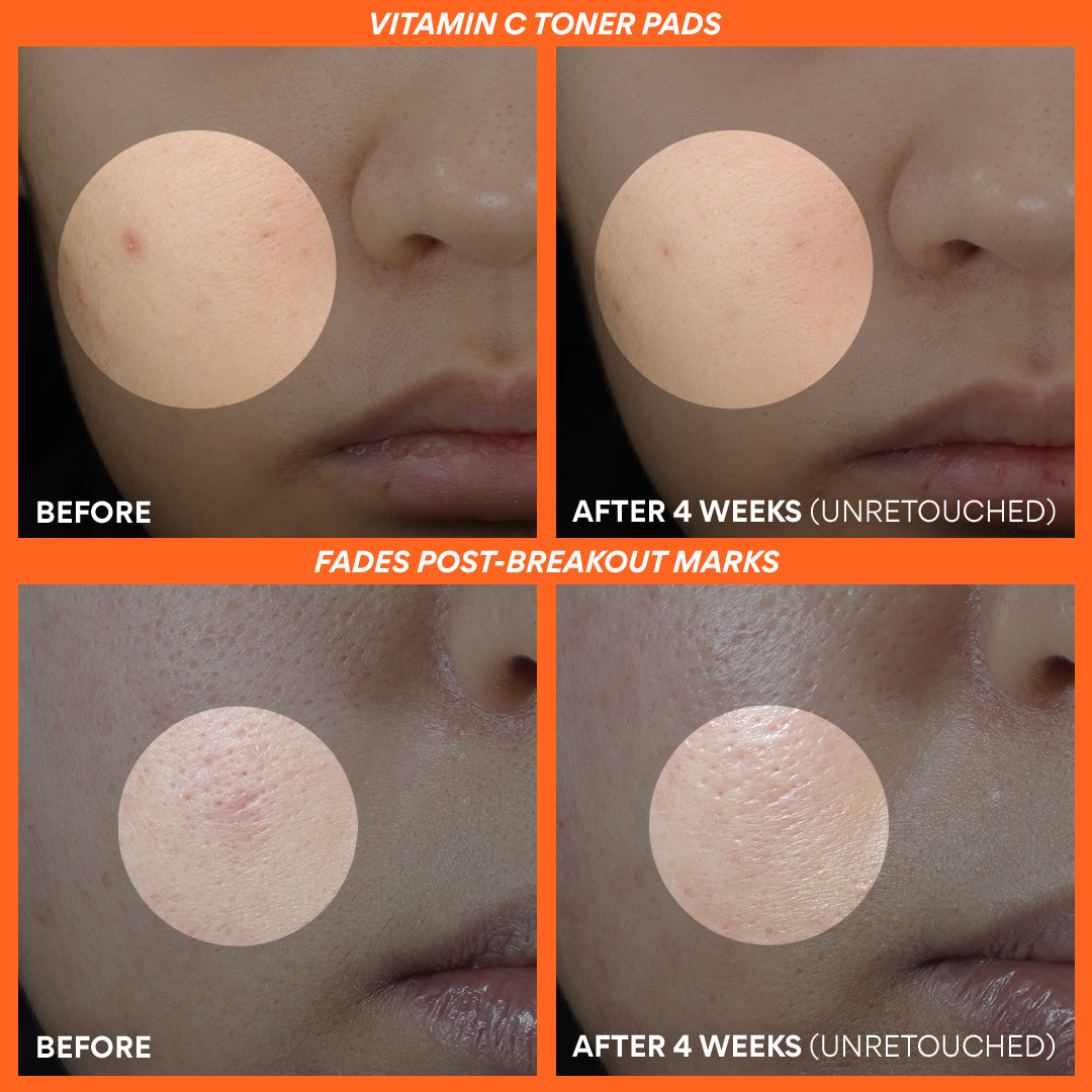 Vitamin C Brightening Power Duo - Skin Brightening Serum & Moisturizer Set for Glowing Complexion | Perfect for Daily Skincare Routine & Anti-Aging Care