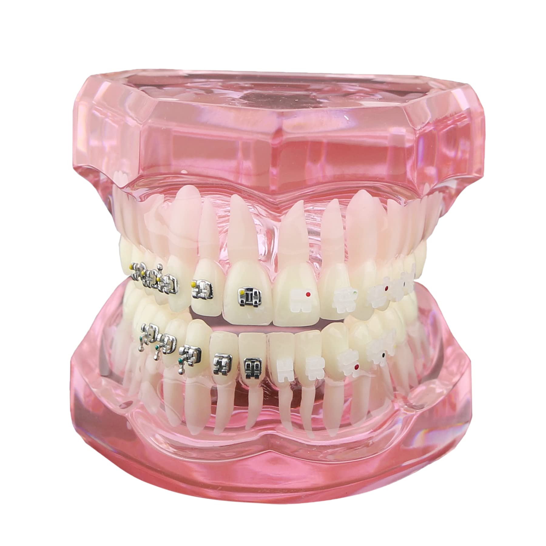 Dental Orthodontic Teeth Model with Metal & Ceramic Brackets - Professional Study Teeth Model for Dentists, Students & Orthodontic Training | Perfect for Dental Education, Practice & Office Display