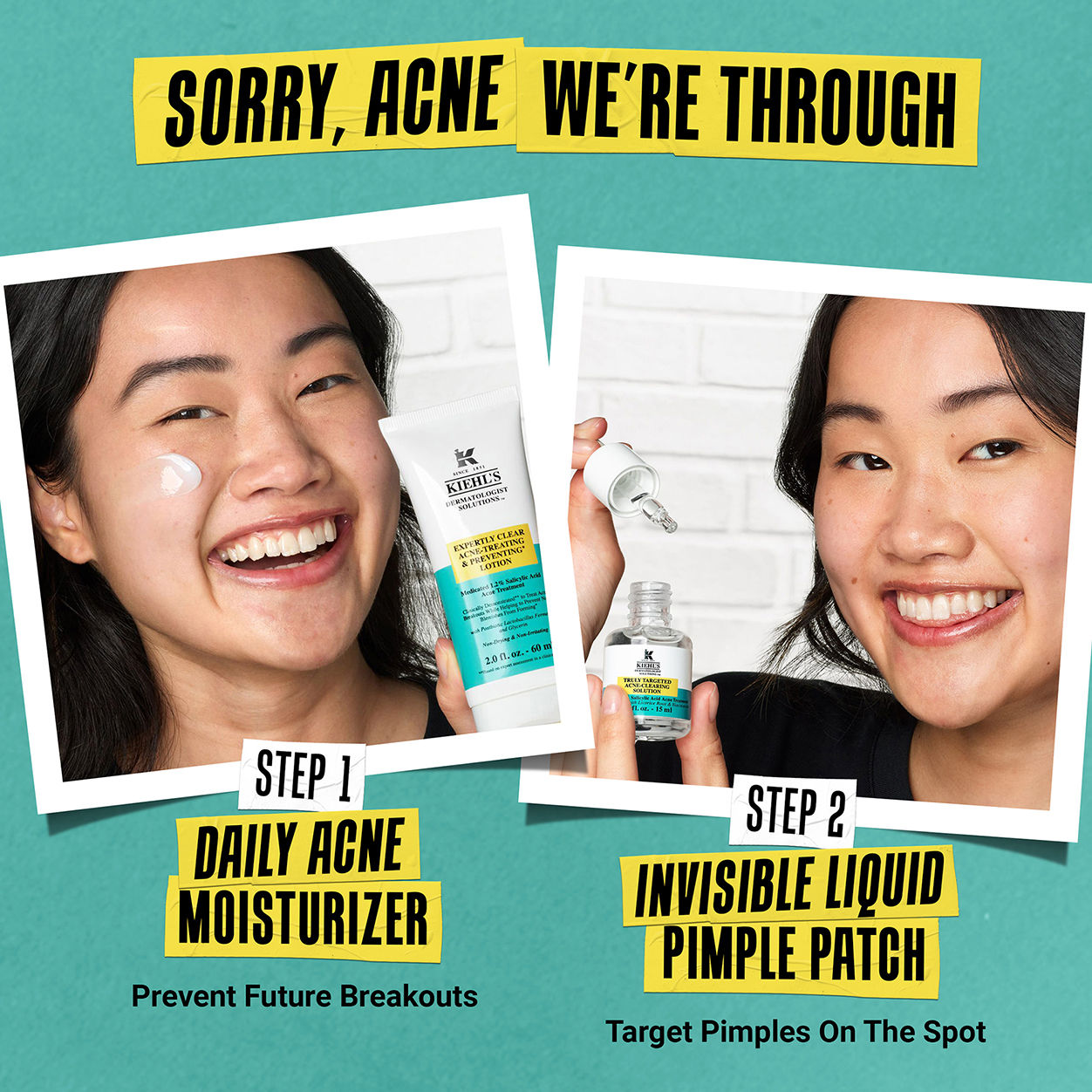 Best Acne Treatment Lotion for Clear Skin - Expert Formula to Prevent & Treat Breakouts | Perfect for Daily Skincare & Acne-Prone Skin