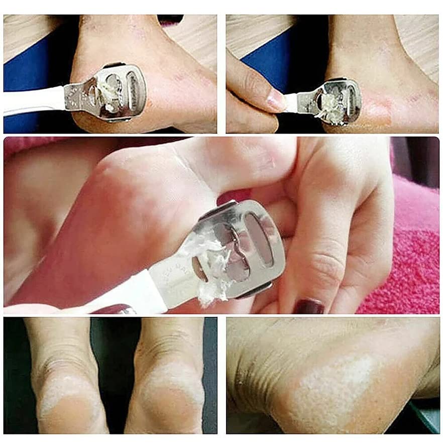 MeeTo Callus Shaver - Stainless Steel Foot Razor for Dead Skin Removal | Pedicure & Heel Care at Home