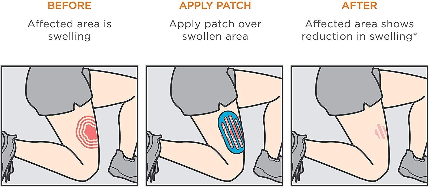 KT Tape Recovery+ Patch - Pain Relief for Swelling & Inflammation | Muscle & Joint Support for Athletes & Active Lifestyles | Post-Workout Recovery Aid