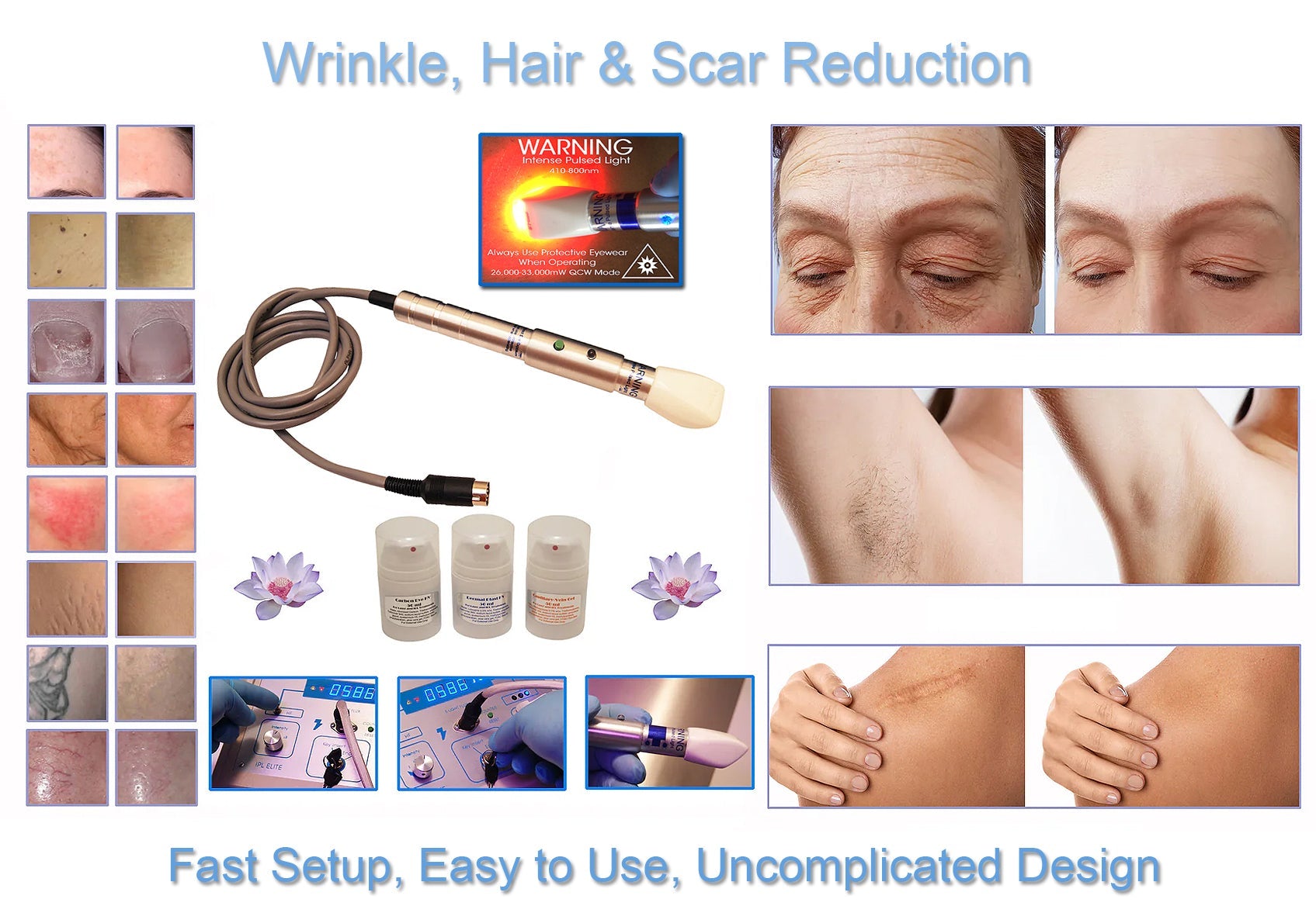 IPL750 E Light System - Hair Removal Device for Smooth Skin, Reduces Scars, Wrinkles & Spider Veins | At-Home IPL Hair Removal & Skin Rejuvenation | Perfect for Face, Legs, Arms & Bikini Line