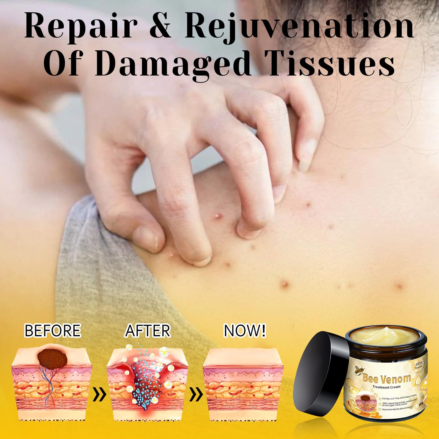 2025 New Bee Venom Treatment Cream - Professional Natural Repair Gel for All Skin Types (2 Bottles) | Soothes Dryness, Redness & Skin Irritation | Perfect for Daily Skincare & Post-Treatment Care