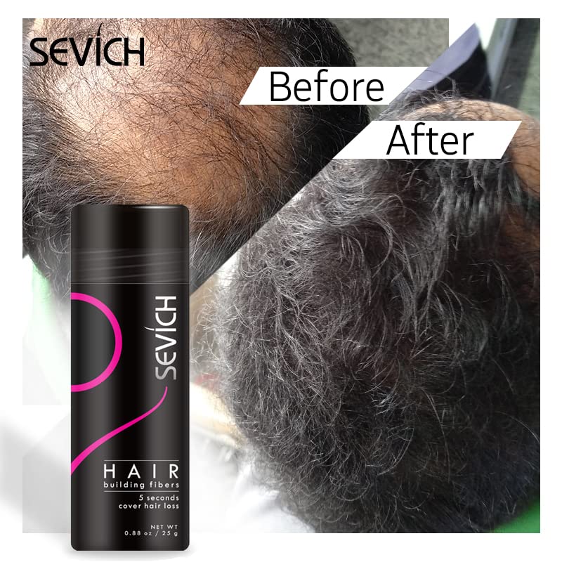 Sevich All Hair Building Fiber Refill - 25g Black Hair Thickening Powder for Men & Women - Instant Hair Loss Concealer for Thinning Hair - Perfect for Daily Use, Special Occasions & Confidence Boosting