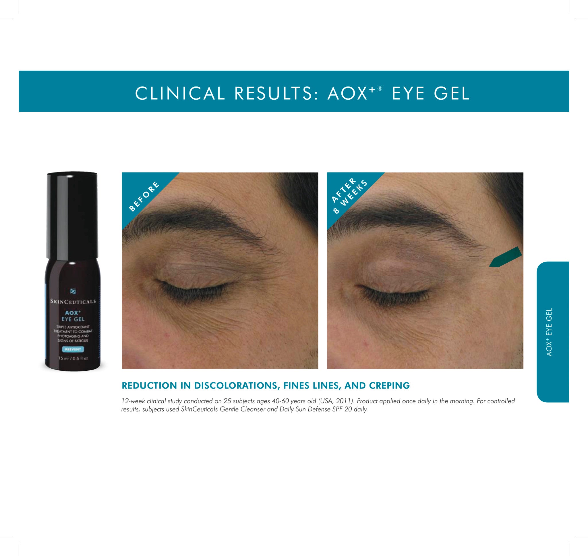 Skinceuticals AOX+ Eye Gel - Antioxidant Eye Treatment for Dark Circles & Puffiness - Perfect for Morning & Night Skincare Routine