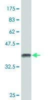 Anti-EPN2 Mouse Polyclonal Antibody (50µl) - High-Quality Research Antibody for Western Blot, Immunoprecipitation & Immunofluorescence Studies