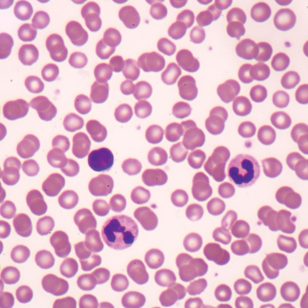 Human Blood Film Slide - Wright's Stained Microscope Smear for Medical Diagnosis, Hematology Lab Testing & Research | Professional Grade Pathology Specimen
