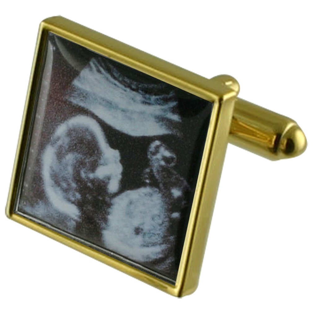 Premium Gold-Tone Square Baby Scan Cufflinks for Men - Elegant Wedding & Formal Attire Accessories with Gift Pouch