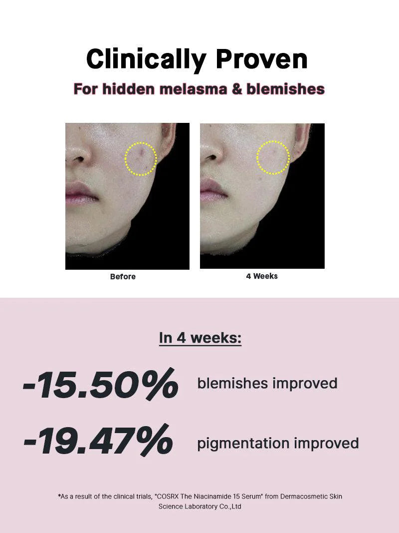 COSRX The Niacinamide 15 Serum 20ml - Brightening & Hydrating Face Serum for Dark Spots & Pores - Perfect for Daily Skincare Routine & Acne-Prone Skin