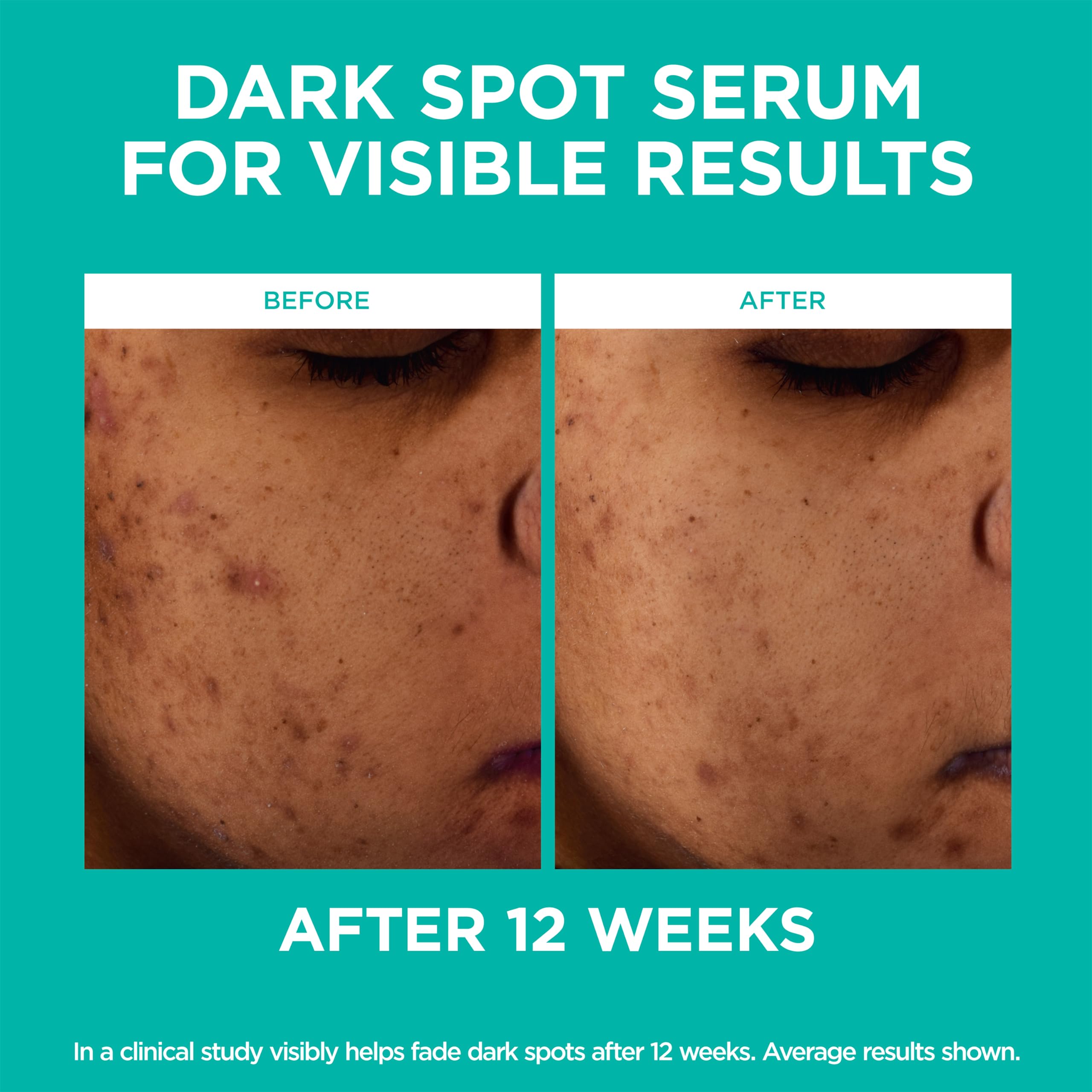 L'Oreal Paris Bright Reveal Niacinamide Dark Spot Serum with SPF 50 - Vitamin C Face Moisturizer for Hyperpigmentation & Uneven Skin Tone - Day & Night Use for Glowing Complexion