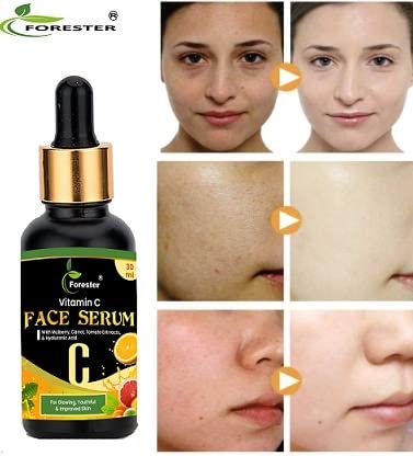 FORESTER 10% Vitamin C Face Serum for Glowing Skin - 30ml Brightening Serum with Highly Stable Vitamin C for Women & Men | Anti-Aging, Dark Spot Treatment, Daily Skincare Routine